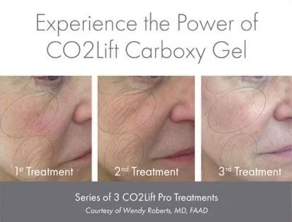 Co2 Lift Pro Mask Kit